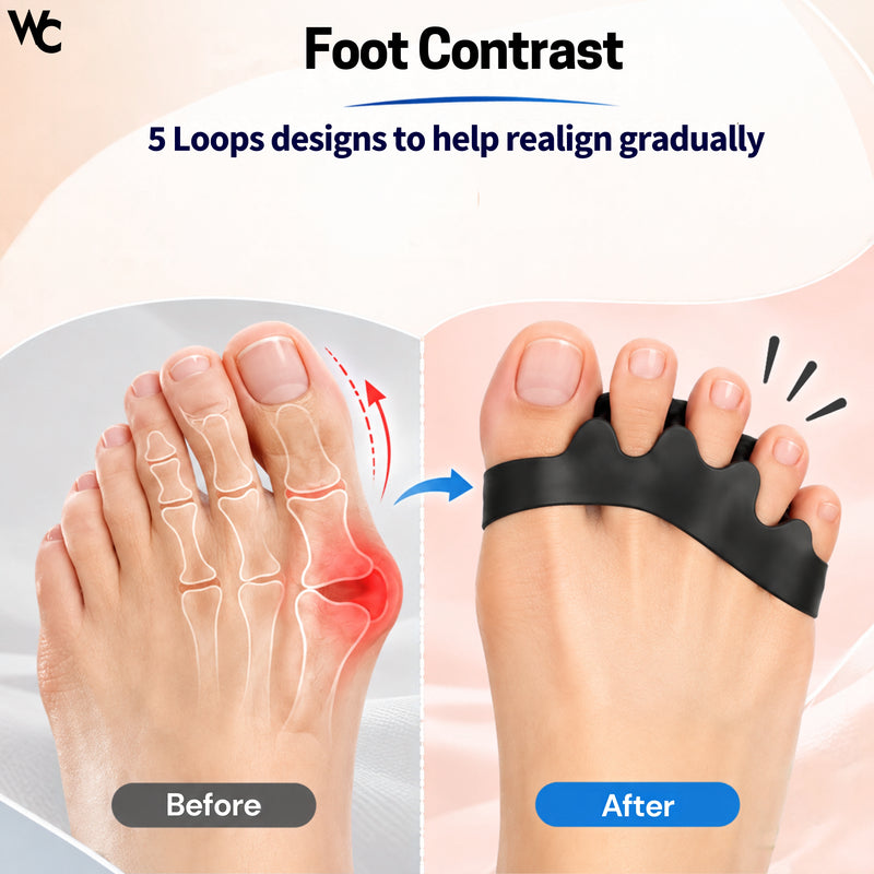 Silicone Toe Separator For Feet Gel Toe Pads Toe Big Toe Corrector Bunion Toe Straightener Yoga Toe Stretcher Hammer Toe Bunion