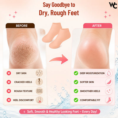 Silicone Heel Protector Socks for Cracked Women & Men | Pain Relief Gel | Foot Alignment | Moisturizing Crack Repair | Arch Support Pad Care Protector