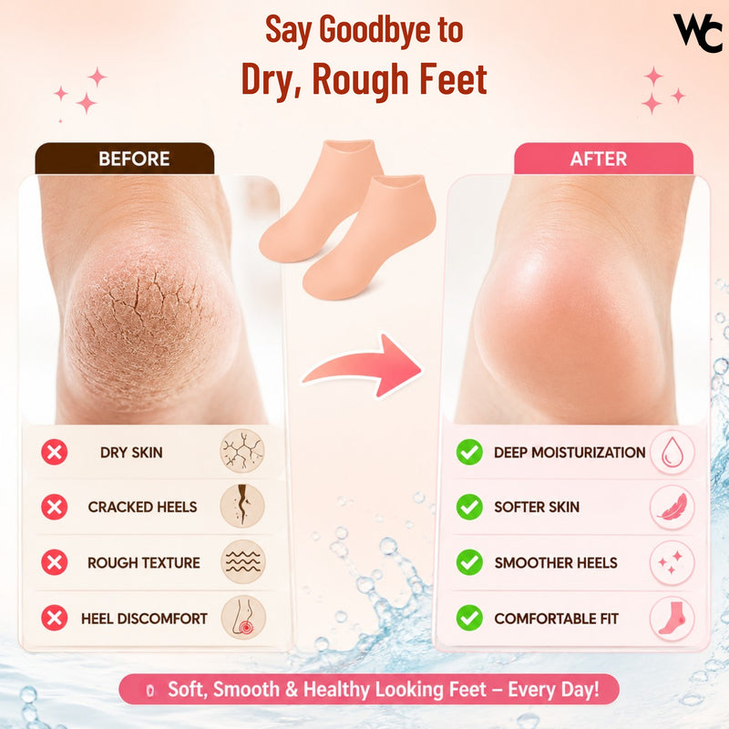 BUY 1 Get 1 FREE Silicone Heel Protector Socks for Cracked Women & Men | Pain Relief Gel | Foot Alignment | Moisturizing Crack Repair | Arch Support Pad Care Protector