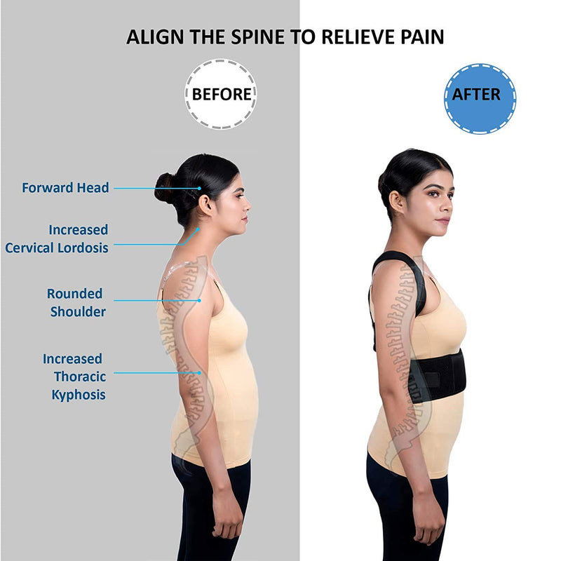 Wonder Care Magnetic Back Posture Corrector