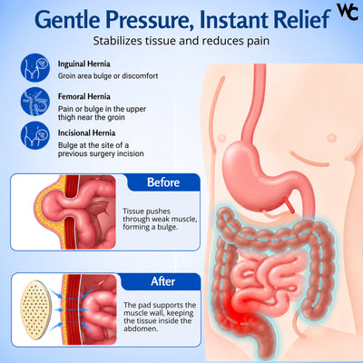Wonder Care Hernia Belt for Men - Groin Hernia Support for Men 2 Removable Compression Pads & Adjustable Groin Straps Double inguinal Hernia Support for Men
