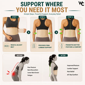 Wonder Care Posture Corrector for Men & Women – Back Posture Correction Brace | Spine Alignment Support | Body Posture Fix | Posture Aid for Office, Gym & Daily Use |Beige