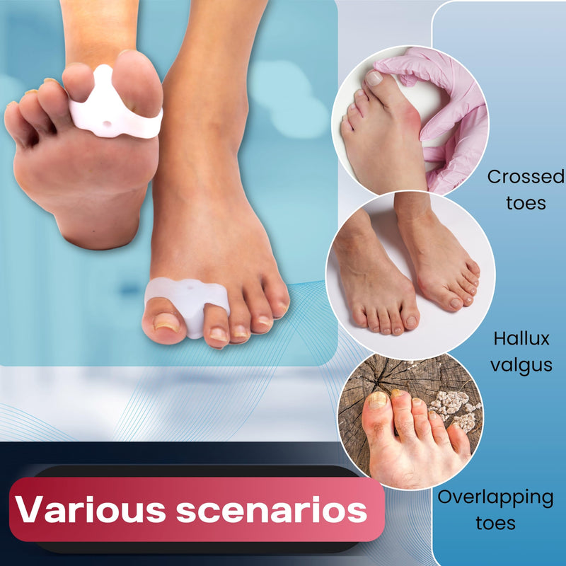 Wonder Care Silicone Toe Separator Blue White Combo