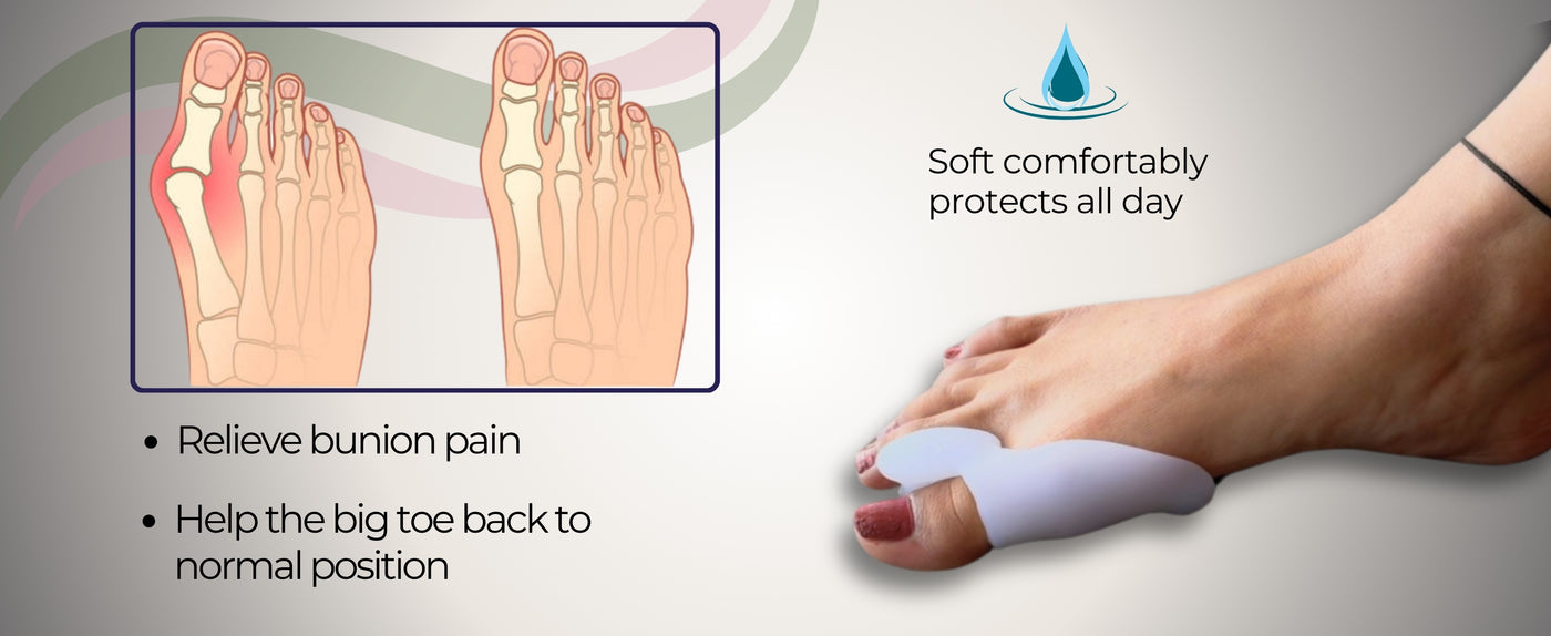  Relieve Your Bunion pain