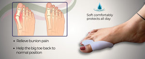 aplus| Relieve Your Bunion pain