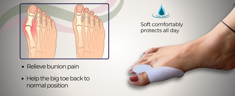 aplus| Relieve Your Bunion pain