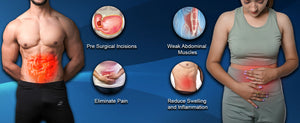 aplus| Umbilical Hernia Support Area